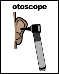 illustration of otoscope