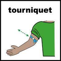 arm with a tourniquet on