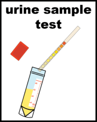 illustration of urine sample test