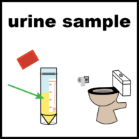 illustration of urine sample and toilet