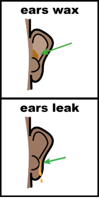 illustrations of ear wax and ear wax leaking
