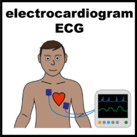 illustration of man with ECG machine on him
